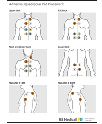 4-Channel Pad Placement - Quadripolar