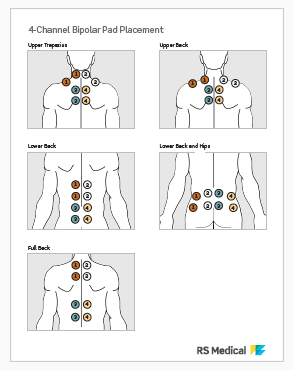 4-Channel Placement - Bipolar