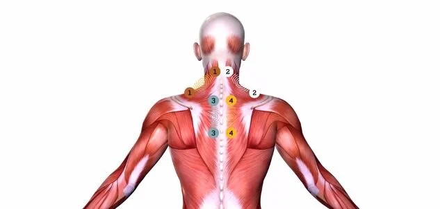 Going Wide &amp; Deep: Pain Relief &amp; the RS-4i® Plus