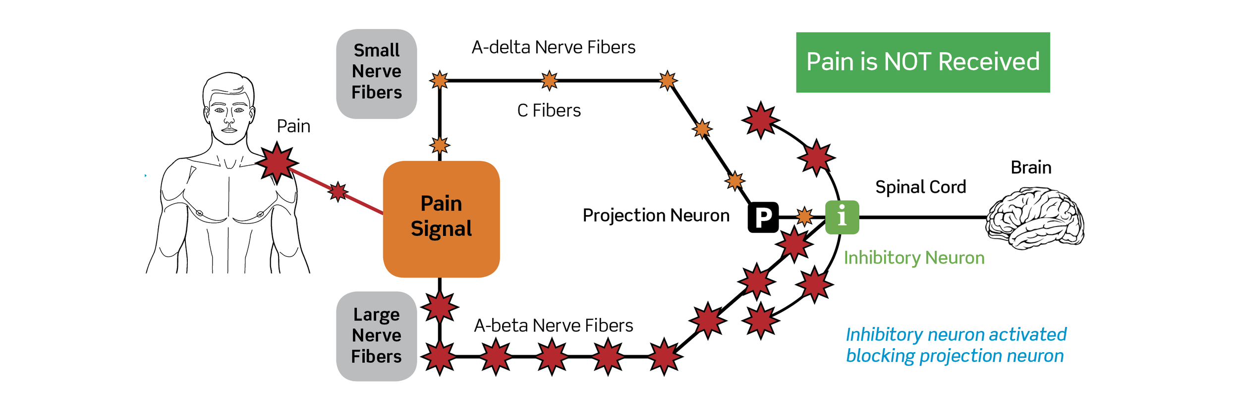 Pain Gate Theory Graphic.png