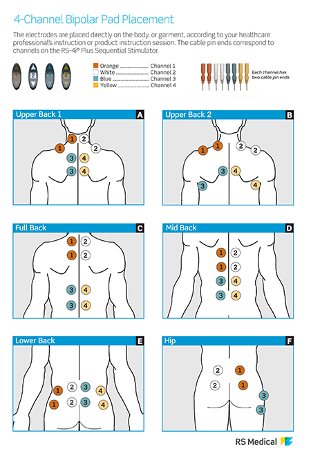 4-Channel Pad Placement-Bipolar